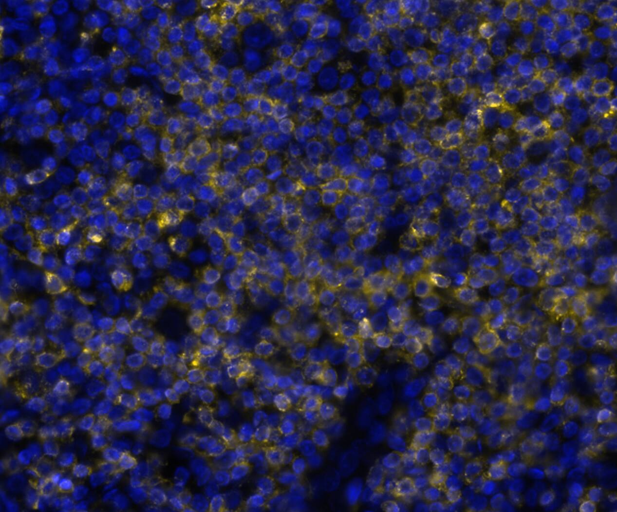 CD7 Antibody (rCD7/6972) Multiplex Immunofluorescence: CD7 Antibody (rCD7/6972) [NBP3-20452]