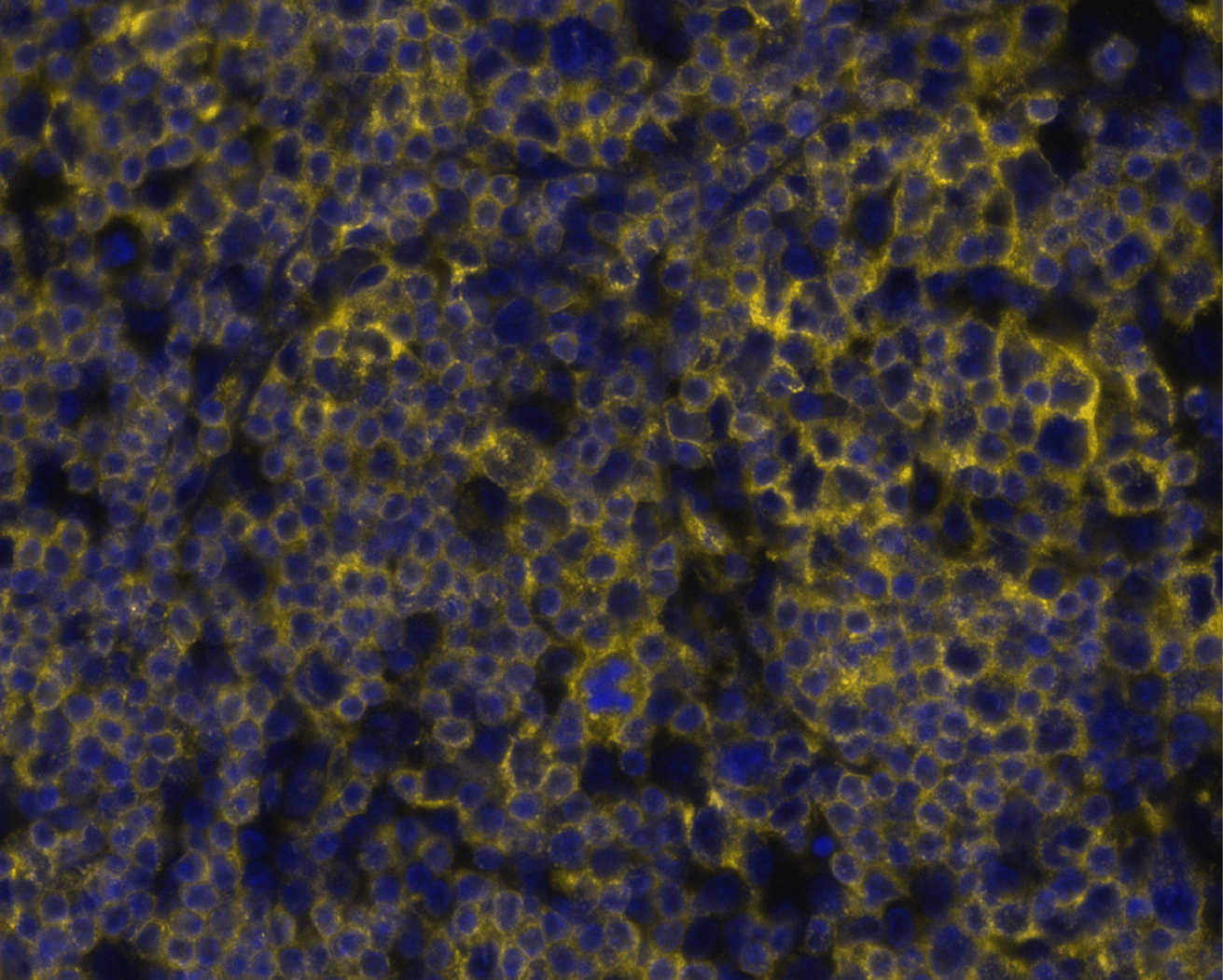 CD7 Antibody (rCD7/6972) Multiplex Immunofluorescence: CD7 Antibody (rCD7/6972) [NBP3-20452]