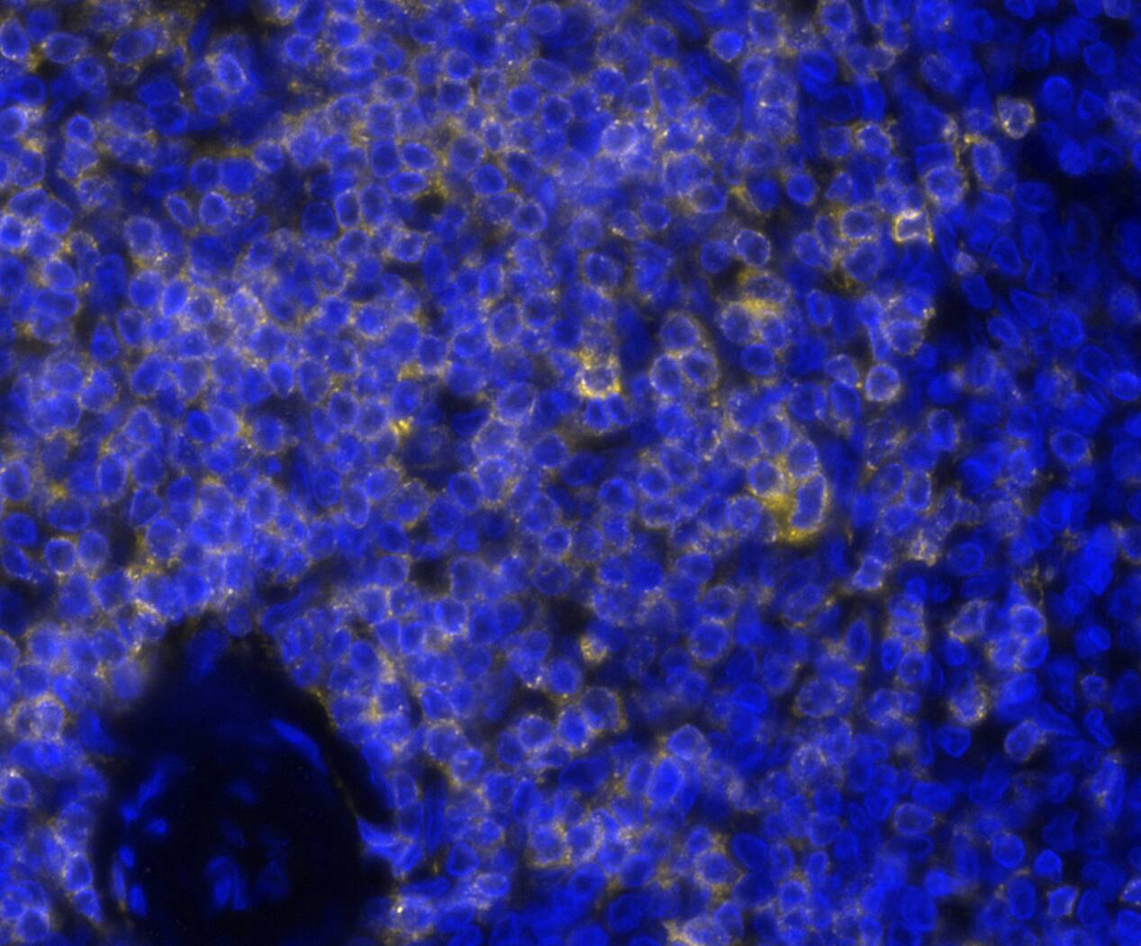 CD7 Antibody (rCD7/6972) Multiplex Immunofluorescence: CD7 Antibody (rCD7/6972) [NBP3-20452]