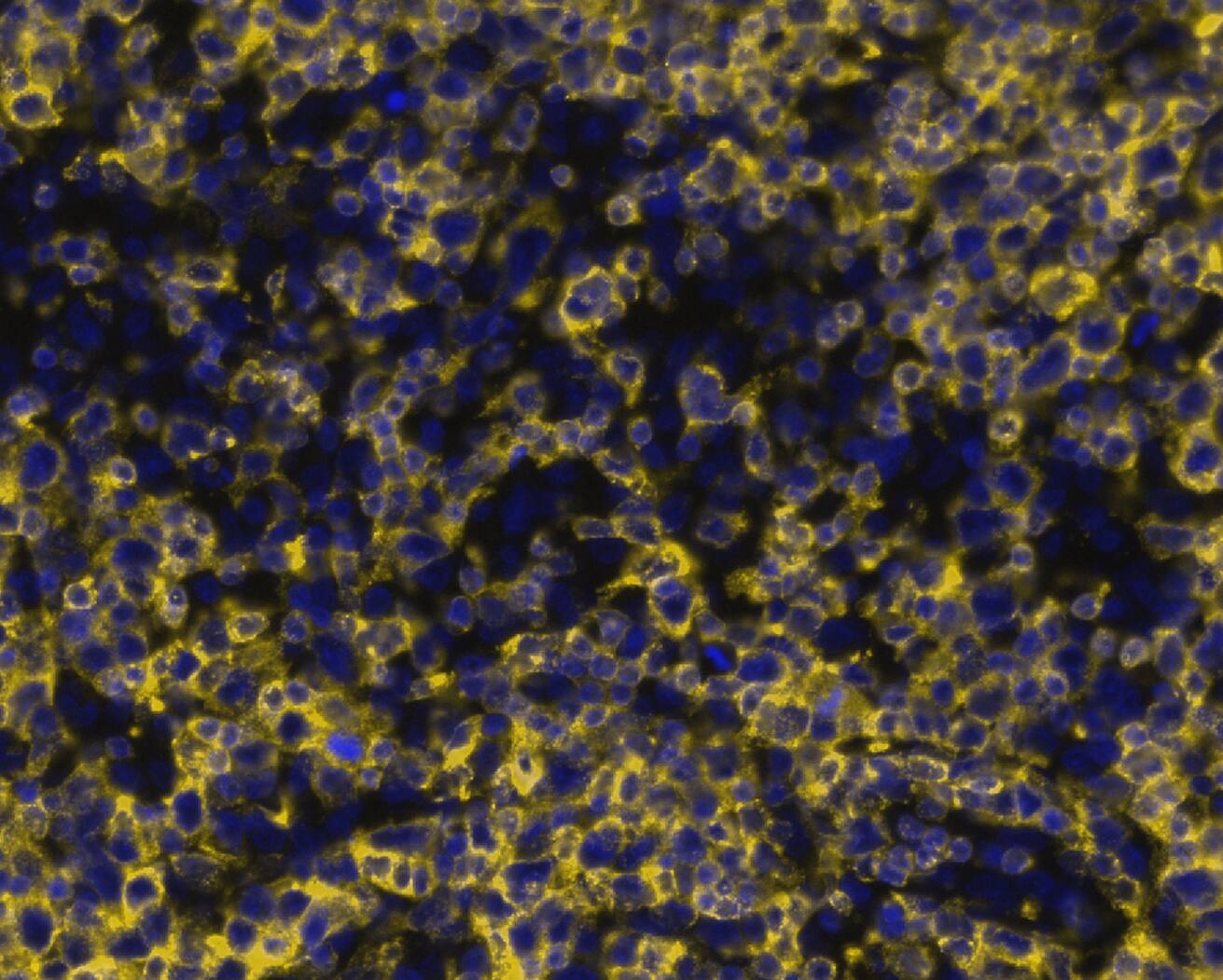 CD7 Antibody (CD7/8118R) CD7 in Human T-Cell Acute LymphoblasticLymphoma via seqIF&trade; staining on COMET&trade;