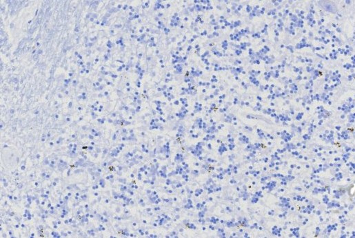MGMT Antibody (MGMT/8128R)