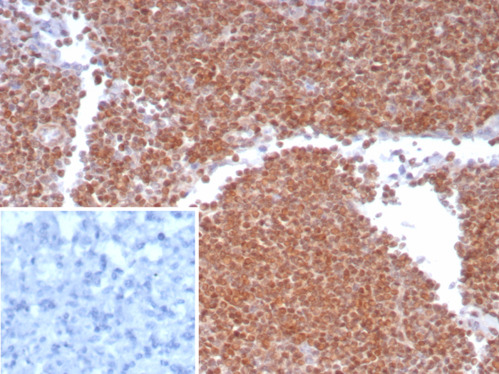 MGMT Antibody (MGMT/8186R)