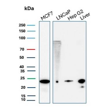 MGMT Antibody (MGMT/8186R) Western Blot: MGMT Antibody (MGMT/8186R) [NBP3-20455] -