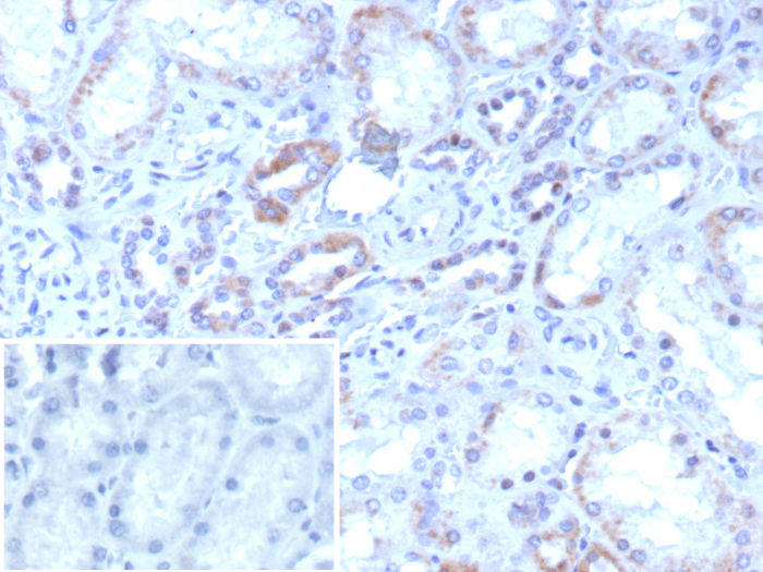 ROR gamma/RORC/NR1F3 Antibody (RORC/8017R)