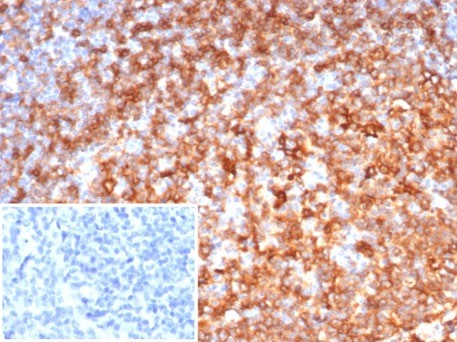HLA DRB1 Antibody (rHLA-DRB/7198)