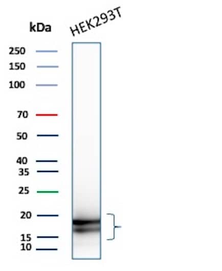 p16INK4a/CDKN2A Antibody (rCDKN2A/8004) Western Blot: p16INK4a/CDKN2A Antibody (rCDKN2A/8004) [NBP3-20460] -