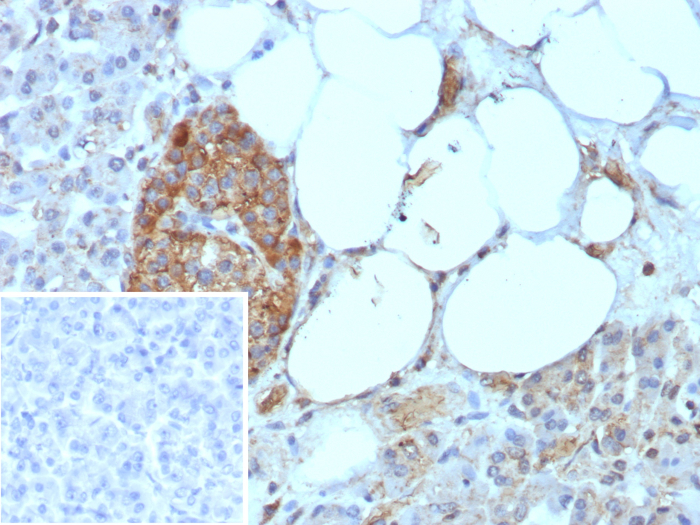 CD99 Antibody (rMIC2/8497)