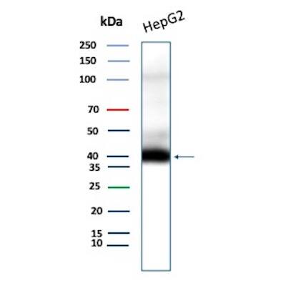 CD7 Antibody (CD7/8496R) Western Blot: CD7 Antibody (CD7/8496R) [NBP3-20469] -