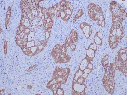 ROS Antibody (ROS1/7999R)