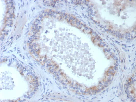 ROS Antibody (ROS1/8268R) ROS Antibody (ROS1/8268R) - Azide and BSA Free