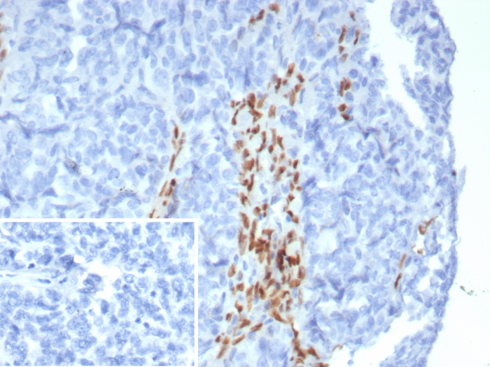 FOXL2 Antibody (FOXL2/8362R)