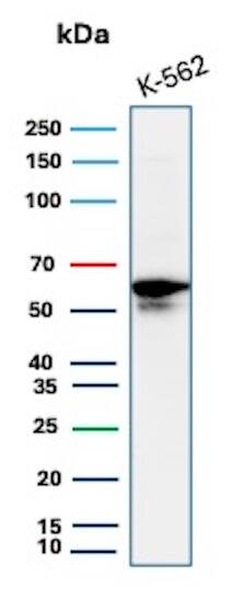 c-Myc Antibody (MYC/7855R) Western Blot: c-Myc Antibody (MYC/7855R) [NBP3-20493] -