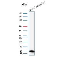 FABP2/I-FABP Antibody (FABP2/7670) Western Blot: FABP2/I-FABP Antibody (FABP2/7670) [NBP3-20497] -