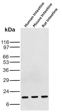 FABP3/H-FABP Antibody (rFABP3/8534) Western Blot: FABP3/H-FABP Antibody (rFABP3/8534) [NBP3-20498] -
