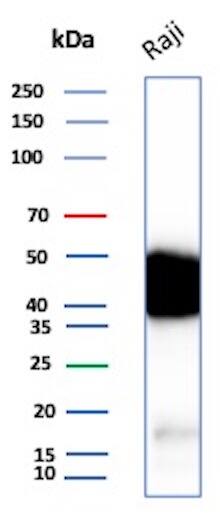 CD48/SLAMF2 Antibody (CD48/8360R) Western Blot: CD48/SLAMF2 Antibody (CD48/8360R) [NBP3-20499] -