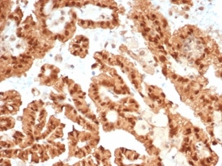 STAT6 Antibody (STAT6/7163R)