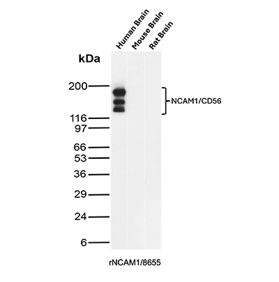 NCAM-1/CD56 Antibody (rNCAM1/8655) Western Blot: NCAM-1/CD56 Antibody (rNCAM1/8655) [NBP3-20517] -
