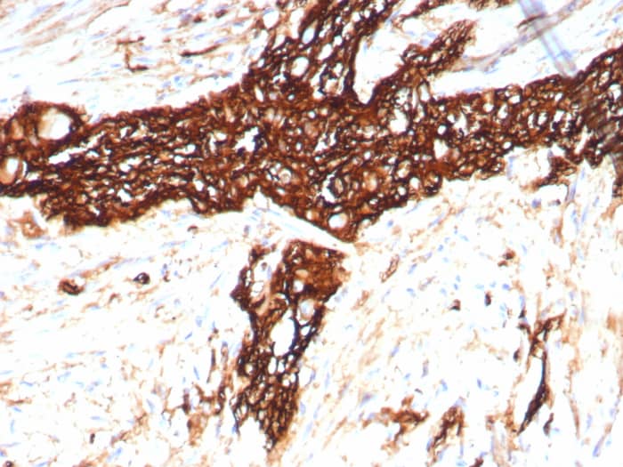 NCAM-1/CD56 Antibody (rNCAM1/8758) NCAM-1/CD56 Antibody (rNCAM1/8758) - Azide and BSA Free