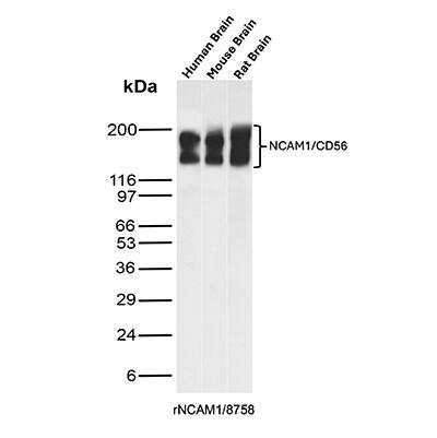 NCAM-1/CD56 Antibody (rNCAM1/8758) Western Blot: NCAM-1/CD56 Antibody (rNCAM1/8758) [NBP3-20518] -
