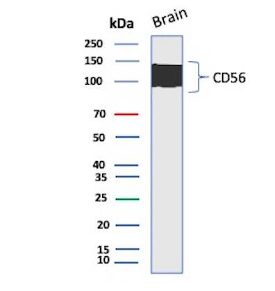 NCAM-1/CD56 Antibody (rNCAM1/8758) Western Blot: NCAM-1/CD56 Antibody (rNCAM1/8758) [NBP3-20518] -