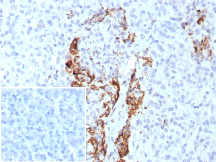 Insulin Antibody (rIRDN/8546)
