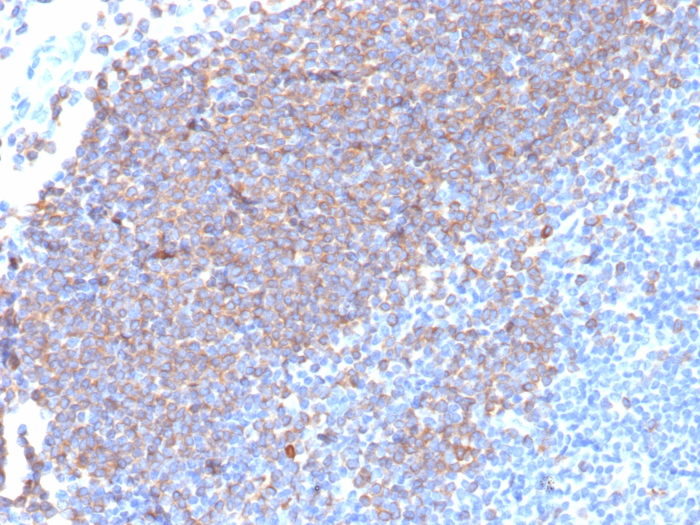 CD79A Antibody (rIGA/6986)