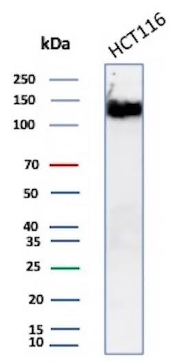 NCAM-1/CD56 Antibody (NCAM1/8392R) Western Blot: NCAM-1/CD56 Antibody (NCAM1/8392R) [NBP3-20529] -