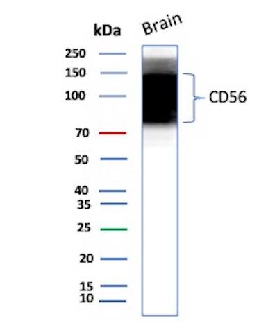 NCAM-1/CD56 Antibody (NCAM1/8392R) Western Blot: NCAM-1/CD56 Antibody (NCAM1/8392R) [NBP3-20529] -