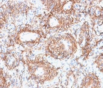 Fibrillin 1 Antibody (FBN1/2191)