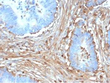 Fibrillin 1 Antibody (FBN1/6933)