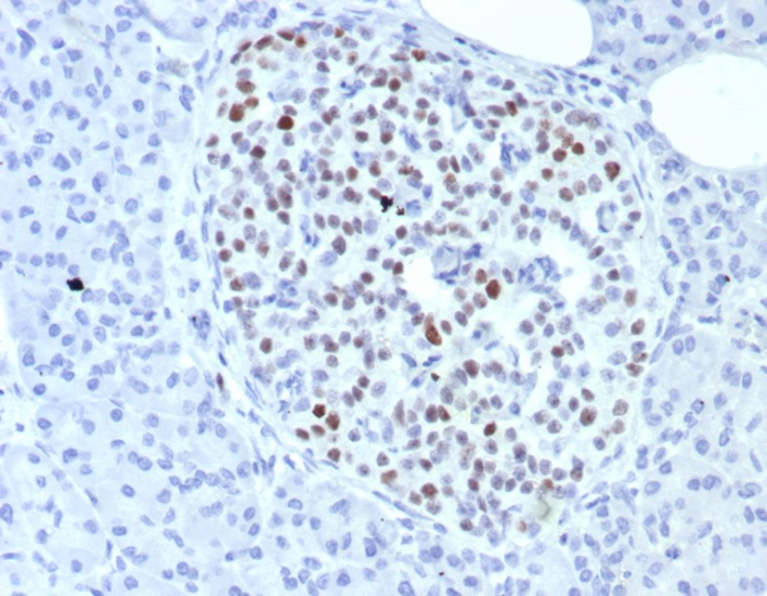 INSM1 Antibody (INSM1/8149R)