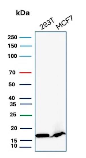 NM23-H2/NME2 Antibody (NME2/6435) Western Blot: NM23-H2/NME2 Antibody (NME2/6435) [NBP3-20542] -