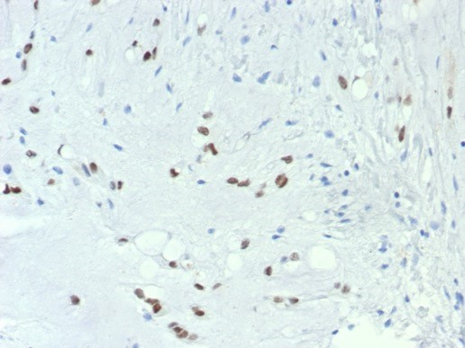 Brachyury Antibody (TBXT/7711R)