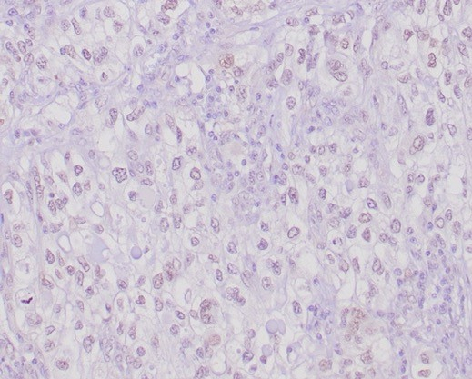 Transcription factor E3 Antibody (TFE3/6849R)