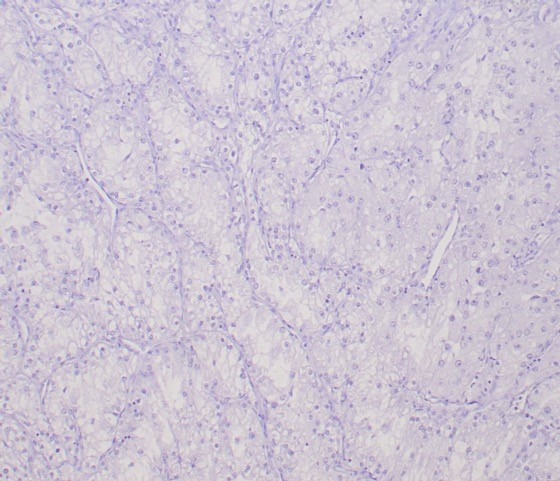 Transcription factor E3 Antibody (TFE3/6849R)