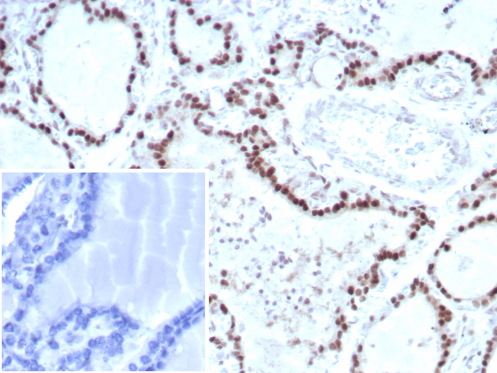 Transcription factor E3 Antibody (TFE3/8663R)