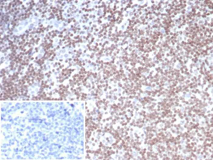 SmarcAL1 Antibody (PCRP-SMARCAL1-1C4)