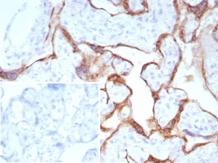 Pappalysin-1/PAPP-A Antibody (PAPPA/8804R) Pappalysin-1/PAPP-A Antibody (PAPPA/8804R) - Azide and BSA Free