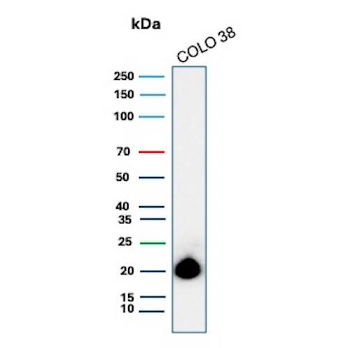 Melan-A/MART-1 Antibody (rMLANA/8134) Western Blot: Melan-A/MART-1 Antibody (rMLANA/8134) [NBP3-20559] -