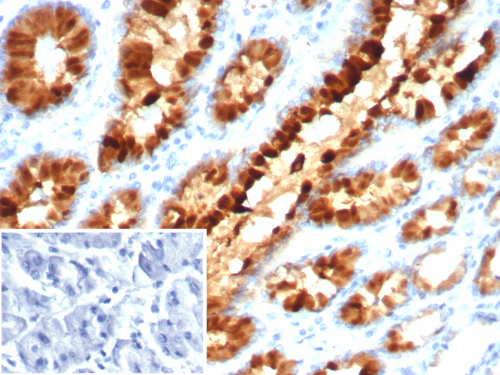TFF1/pS2 Antibody (TFF1/7891)