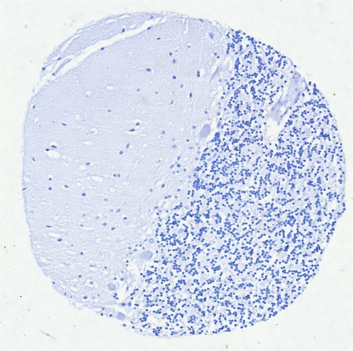 IRF4 Antibody (MUM1/8560R)