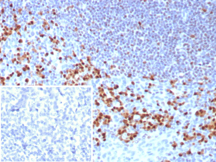 IRF4 Antibody (MUM1/8560R)