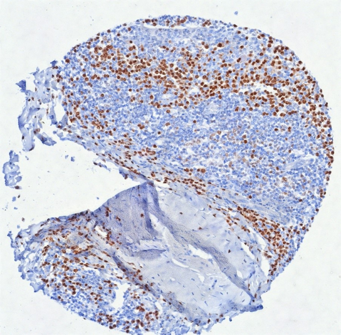 IRF4 Antibody (MUM1/8560R)
