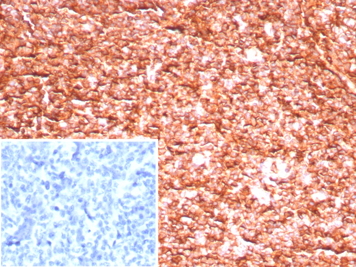 HLA ABC Antibody (MHC-I/8147R)