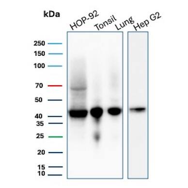 HLA ABC Antibody (MHC-I/8147R) Western Blot: HLA ABC Antibody (MHC-I/8147R) [NBP3-20573] -