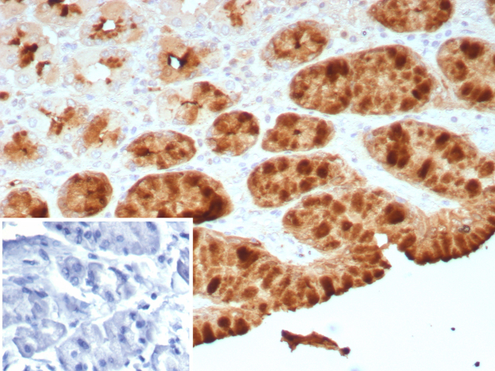 TFF1/pS2 Antibody (TFF1/8755R)