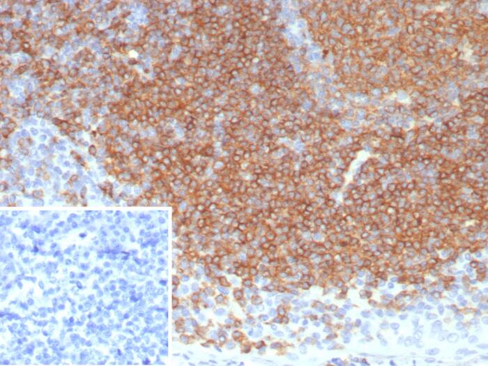 Siglec-2/CD22 Antibody (BLCAM/8113R) Siglec-2/CD22 Antibody (BLCAM/8113R) - Azide and BSA Free