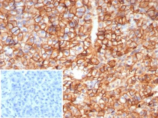 CD99 Antibody (MIC2/8119R)