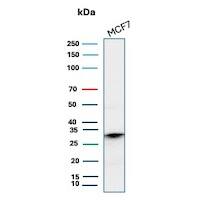 CD99 Antibody (MIC2/8119R) Western Blot: CD99 Antibody (MIC2/8119R) [NBP3-20586] -