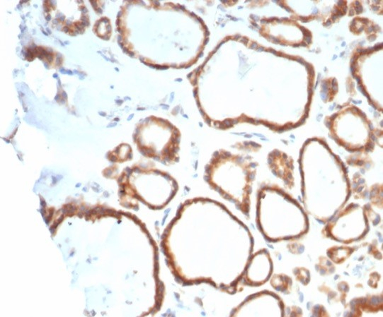 HSP90 beta Antibody (HSP90AB1/4970)